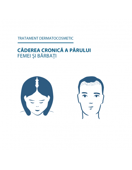 Ducray Neoptide Homme lotiune, 100ml, LAB. PIERRE FABRE FRANTA