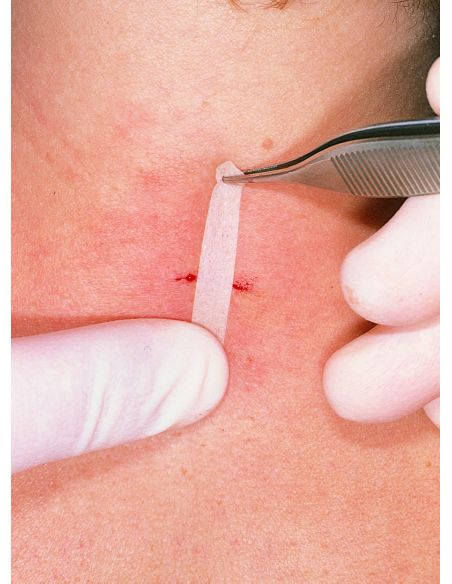 Omnistrip 12mm x 101 mm - plasture pentru inlocuirea suturilor chirurgicale, 50 bucati, PAUL HARTMANN AG