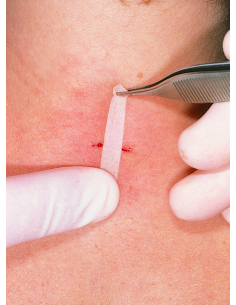 Omnistrip 3mm x 76 mm - plasture pentru inlocuire... 2