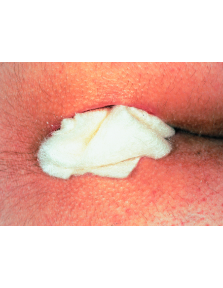 Sorbalgon 10 x 10 cm  - pansament din alginat de calciu, 10 bucati, PAUL HARTMANN AG