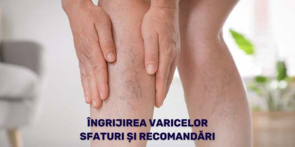 Îngrijirea varicelor. Sfaturi și recomandări